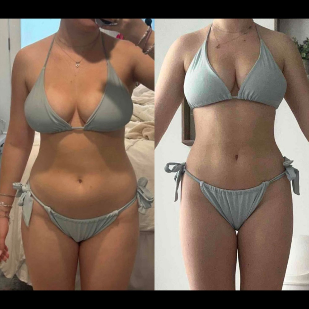Transformation 10