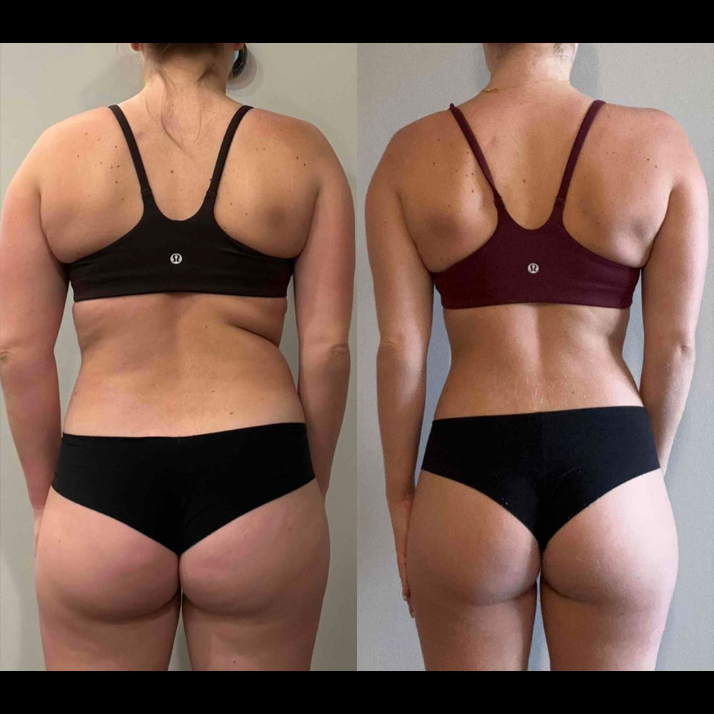 Transformation 9